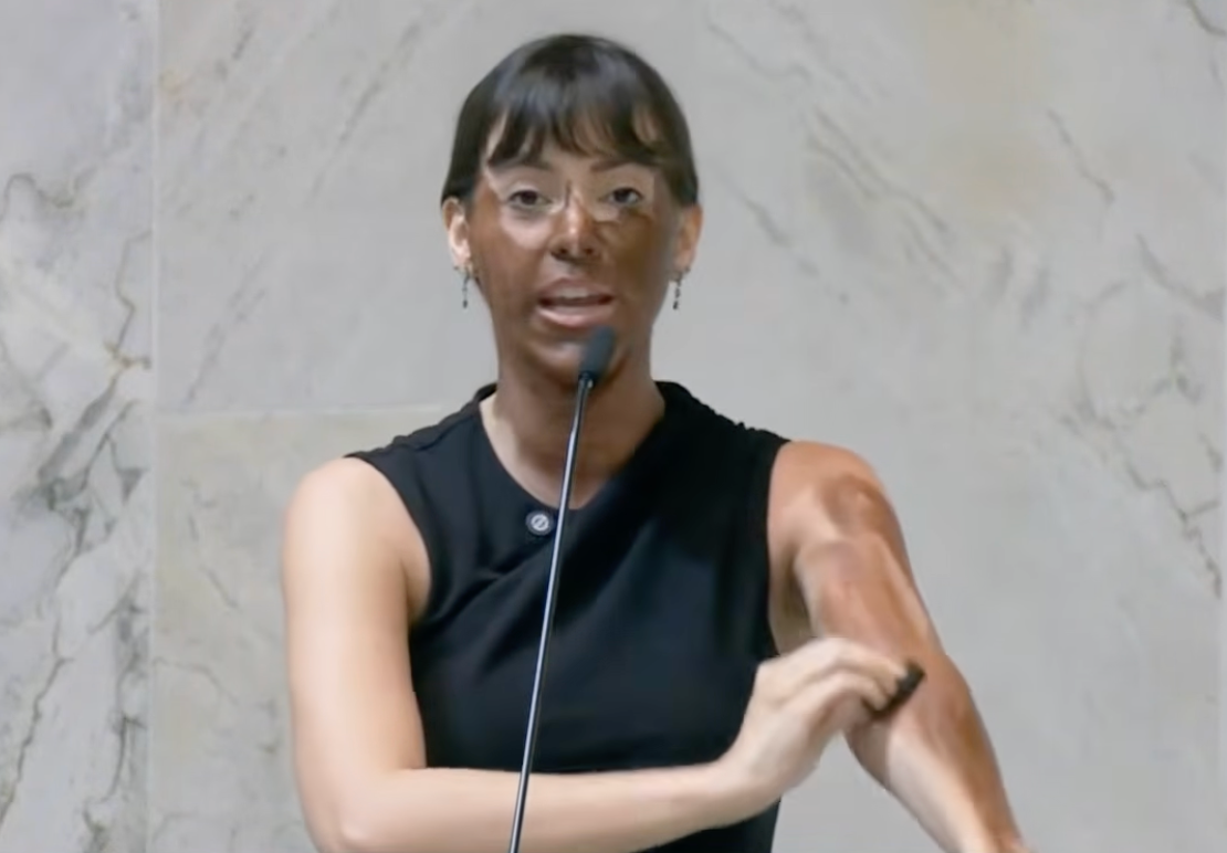 Fabiana Bolsonaro usa blackface em protesto na Alesp; deputada reage